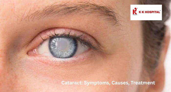 Cataract